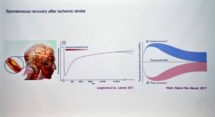Examinan formas de recuperación del cerebro, luego de un infarto ...