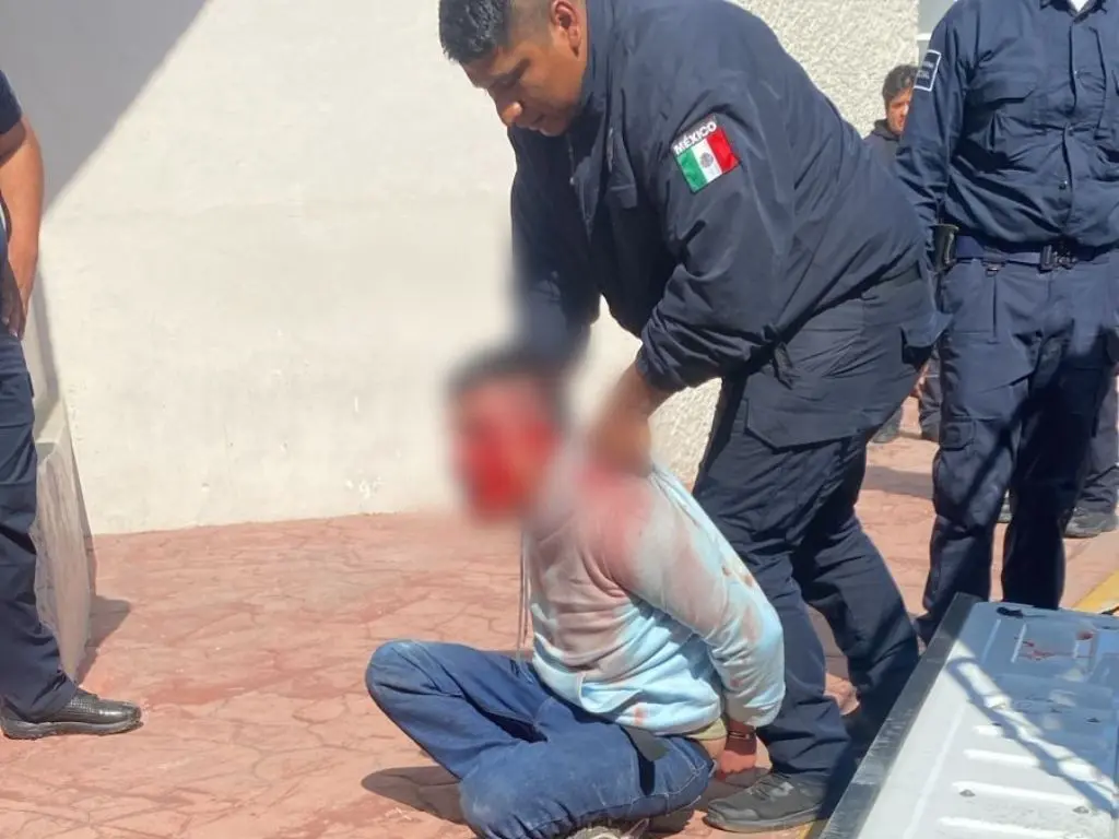Rescatan a bebé golpeado por su padre en Ecatepec   Amexi