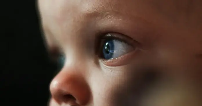 Entre las causas más comunes del ojo perezoso se encuentra el estrabismo (cuando los ojos no están alineados correctamente).