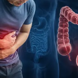 Cáncer de colon aumenta en México y afecta cada vez a personas más jóvenes