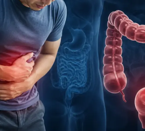 Cáncer de colon aumenta en México y afecta cada vez a personas más jóvenes | 15 mil nuevos casos al año cáncer colorrectal se dispara en México